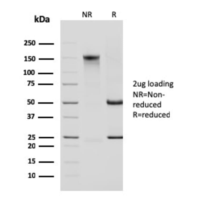 SDS-PAGE - Anti-Cytokeratin 14 Antibody [KRT14/2375] - BSA and Azide free (A252355) - Antibodies.com