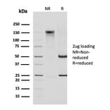 SDS-PAGE - Anti-Cytokeratin 14 Antibody [KRT14/2375] - BSA and Azide free (A252355) - Antibodies.com
