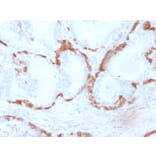 Immunohistochemistry - Anti-Cytokeratin 14 Antibody [KRT14/2375] - BSA and Azide free (A252355) - Antibodies.com