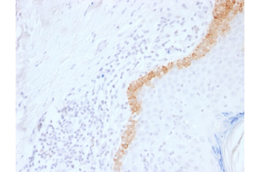 Immunohistochemistry - Anti-Cytokeratin 15 Antibody [LHK15] - BSA and Azide free (A252355) - Antibodies.com