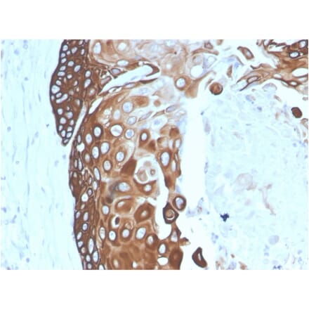 Immunohistochemistry - Anti-Cytokeratin 15 Antibody [SPM190] - BSA and Azide free (A252356) - Antibodies.com