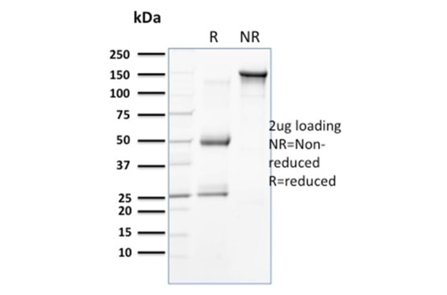 SDS-PAGE - Anti-Cytokeratin 15 Antibody [SPM190] - BSA and Azide free (A252357) - Antibodies.com