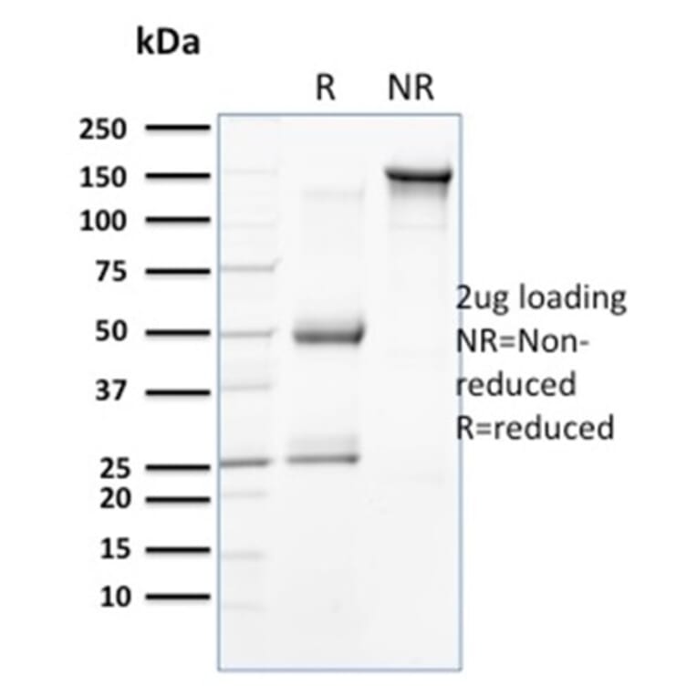 SDS-PAGE - Anti-Cytokeratin 15 Antibody [SPM190] - BSA and Azide free (A252357) - Antibodies.com