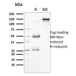 SDS-PAGE - Anti-Cytokeratin 15 Antibody [SPM190] - BSA and Azide free (A252357) - Antibodies.com