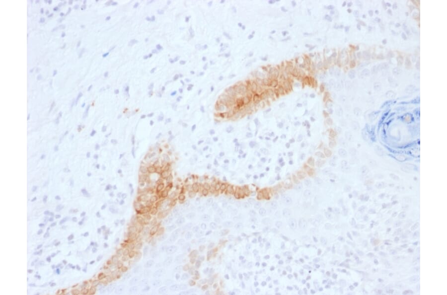 Immunohistochemistry - Anti-Cytokeratin 15 Antibody [KRT15/1699] - BSA and Azide free (A252357) - Antibodies.com