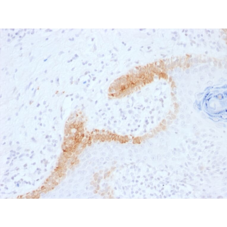 Immunohistochemistry - Anti-Cytokeratin 15 Antibody [KRT15/1699] - BSA and Azide free (A252357) - Antibodies.com