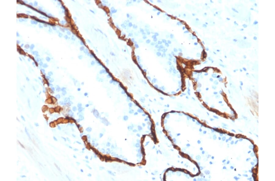 Immunohistochemistry - Anti-Cytokeratin 15 Antibody [KRT15/2554] - BSA and Azide free (A252359) - Antibodies.com