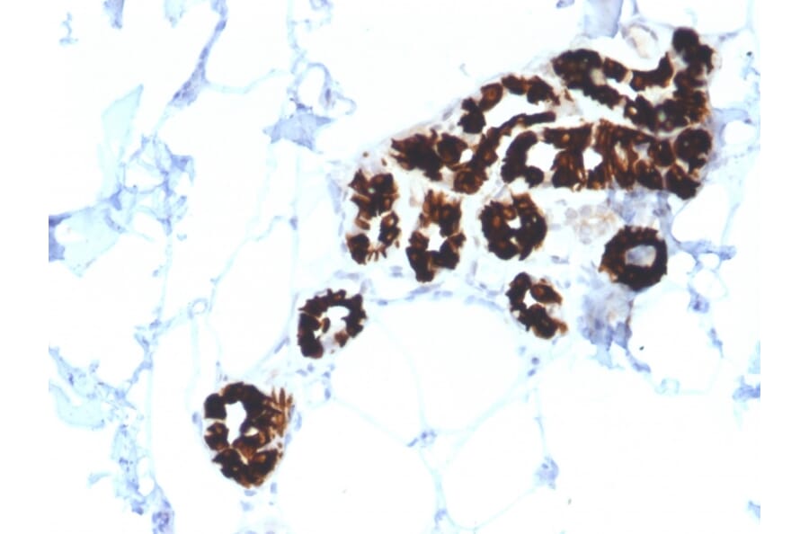 Immunohistochemistry - Anti-Cytokeratin 15 Antibody [KRT15/2554] - BSA and Azide free (A252359) - Antibodies.com