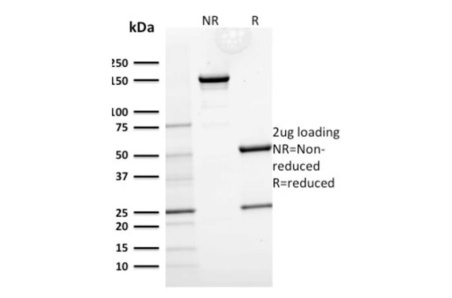 SDS-PAGE - Anti-Cytokeratin 15 Antibody [KRT15/2554] - BSA and Azide free (A252359) - Antibodies.com