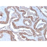 Immunohistochemistry - Anti-Cytokeratin 15 Antibody [KRT15/2957] - BSA and Azide free (A252360) - Antibodies.com
