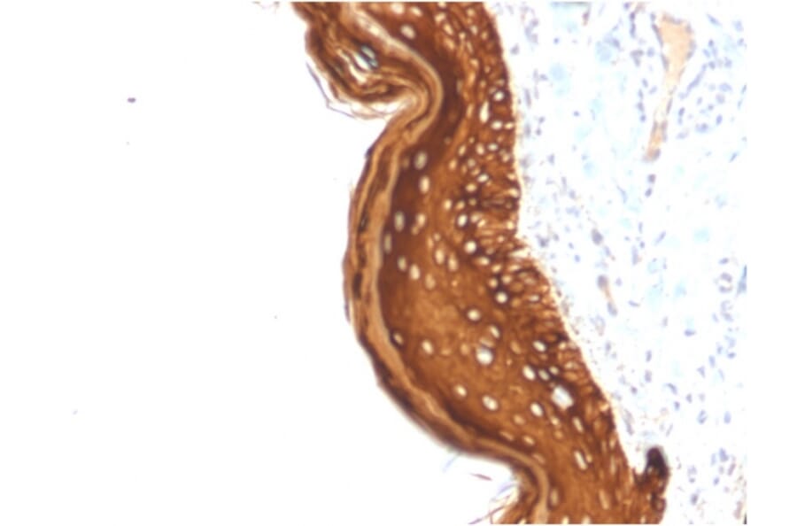 Immunohistochemistry - Anti-Cytokeratin 15 Antibody [KRT15/2957] - BSA and Azide free (A252360) - Antibodies.com