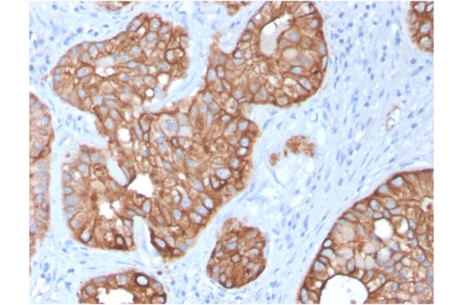 Immunohistochemistry - Anti-Cytokeratin 15 Antibody [KRT15/2957] - BSA and Azide free (A252360) - Antibodies.com