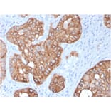 Immunohistochemistry - Anti-Cytokeratin 15 Antibody [KRT15/2957] - BSA and Azide free (A252360) - Antibodies.com