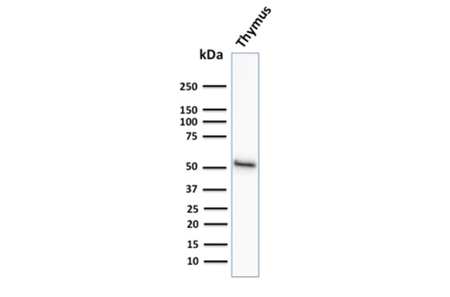 Western Blot - Anti-Cytokeratin 15 Antibody [KRT15/2958] - BSA and Azide free (A252361) - Antibodies.com