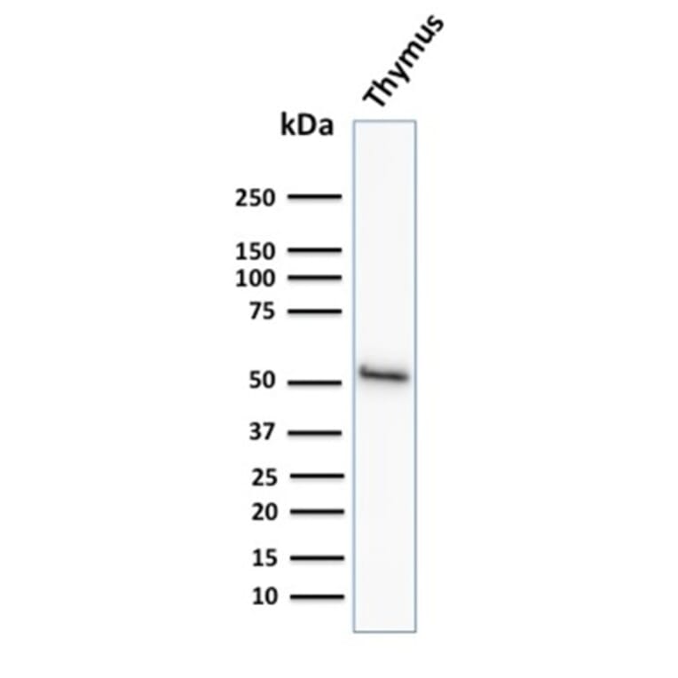 Western Blot - Anti-Cytokeratin 15 Antibody [KRT15/2958] - BSA and Azide free (A252361) - Antibodies.com