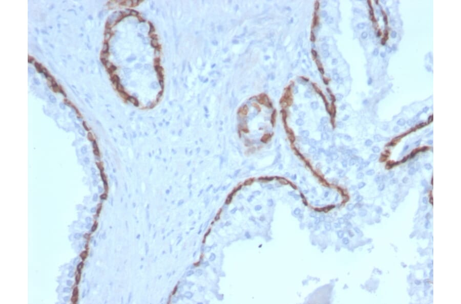 Immunohistochemistry - Anti-Cytokeratin 15 Antibody [KRT15/2958] - BSA and Azide free (A252361) - Antibodies.com
