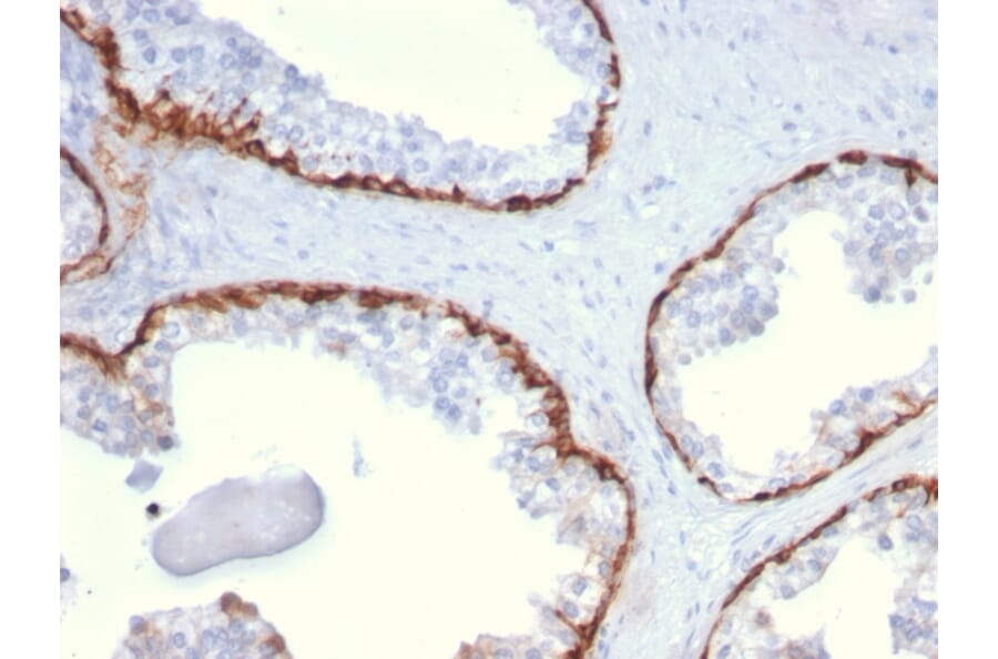 Immunohistochemistry - Anti-Cytokeratin 15 Antibody [KRT15/2959] - BSA and Azide free (A252362) - Antibodies.com