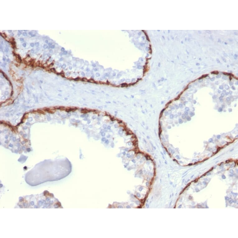 Immunohistochemistry - Anti-Cytokeratin 15 Antibody [KRT15/2959] - BSA and Azide free (A252362) - Antibodies.com