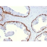 Immunohistochemistry - Anti-Cytokeratin 15 Antibody [KRT15/2959] - BSA and Azide free (A252362) - Antibodies.com