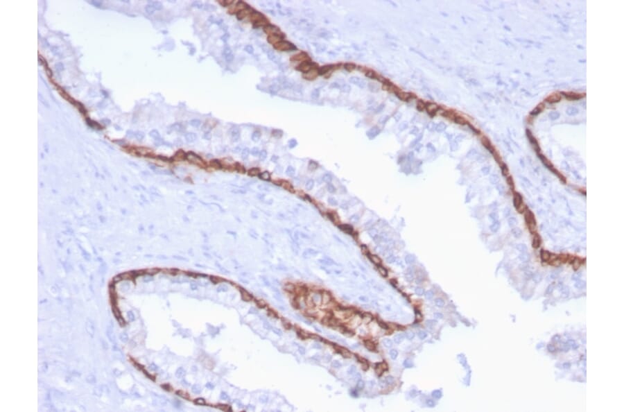 Immunohistochemistry - Anti-Cytokeratin 15 Antibody [KRT15/2959] - BSA and Azide free (A252362) - Antibodies.com