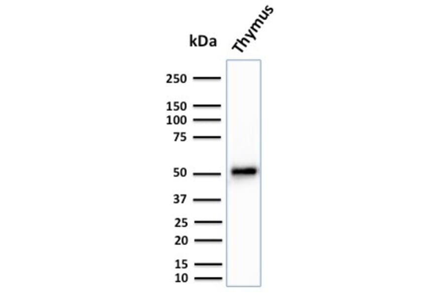 Western Blot - Anti-Cytokeratin 15 Antibody [KRT15/2959] - BSA and Azide free (A252362) - Antibodies.com