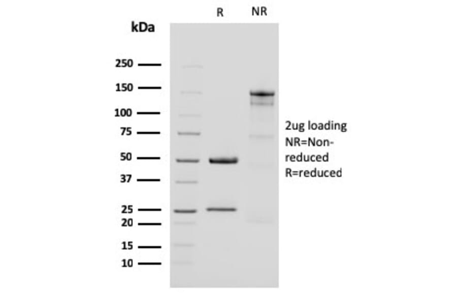 SDS-PAGE - Anti-Cytokeratin 15 Antibody [KRT15/2959] - BSA and Azide free (A252362) - Antibodies.com
