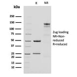SDS-PAGE - Anti-Cytokeratin 15 Antibody [KRT15/2959] - BSA and Azide free (A252362) - Antibodies.com
