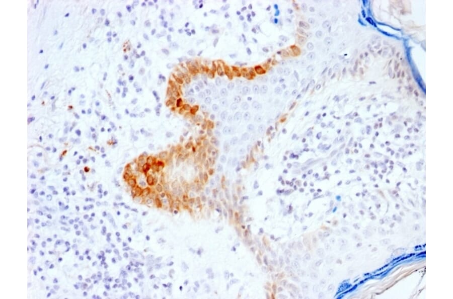 Immunohistochemistry - Anti-Cytokeratin 15 Antibody [KRT15/2103R] - BSA and Azide free (A252363) - Antibodies.com