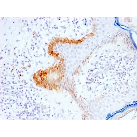 Immunohistochemistry - Anti-Cytokeratin 15 Antibody [KRT15/2103R] - BSA and Azide free (A252363) - Antibodies.com
