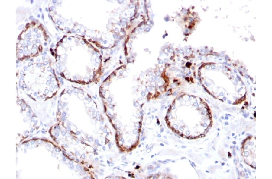 Immunohistochemistry - Anti-Cytokeratin 15 Antibody [KRT15/2103R] - BSA and Azide free (A252363) - Antibodies.com