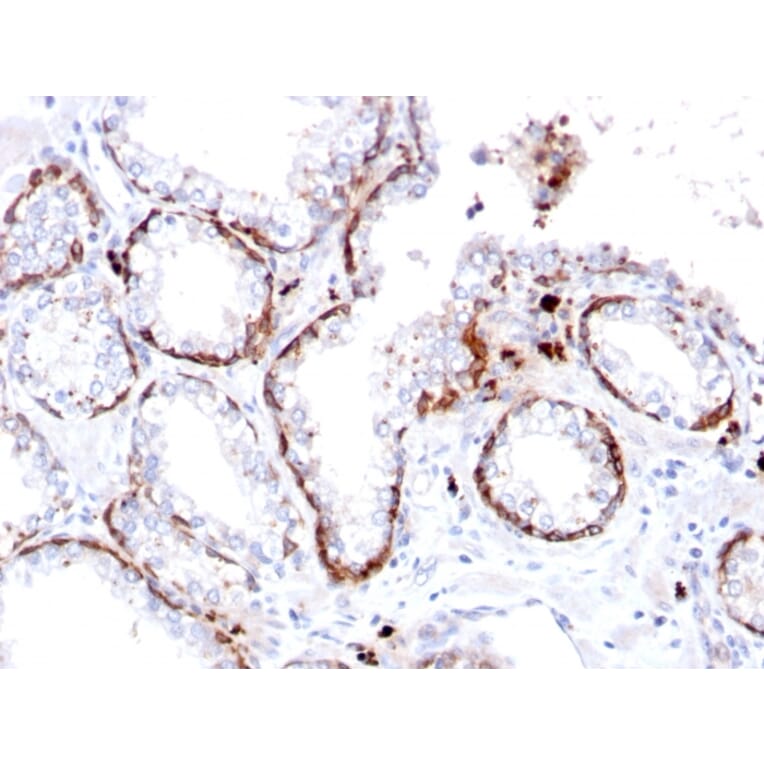 Immunohistochemistry - Anti-Cytokeratin 15 Antibody [KRT15/2103R] - BSA and Azide free (A252363) - Antibodies.com