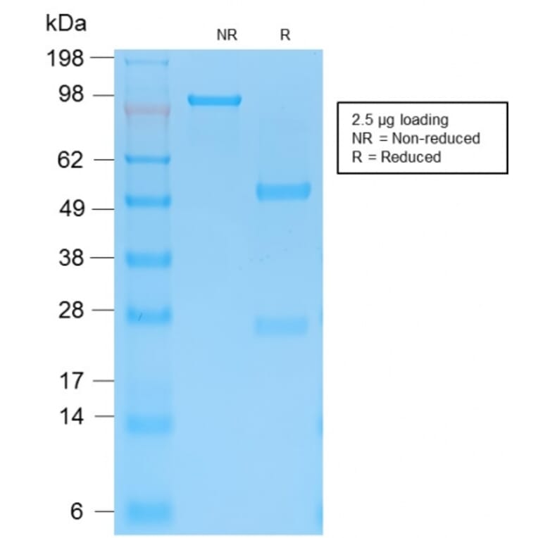 SDS-PAGE - Anti-Cytokeratin 15 Antibody [KRT15/2103R] - BSA and Azide free (A252363) - Antibodies.com