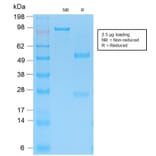 SDS-PAGE - Anti-Cytokeratin 15 Antibody [KRT15/2103R] - BSA and Azide free (A252363) - Antibodies.com
