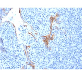 Immunohistochemistry - Anti-Cytokeratin 16 Antibody [LL025] - BSA and Azide free (A252363) - Antibodies.com