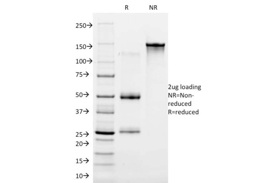 SDS-PAGE - Anti-Cytokeratin 16 Antibody [LL025] - BSA and Azide free (A252364) - Antibodies.com