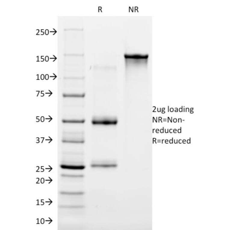 SDS-PAGE - Anti-Cytokeratin 16 Antibody [LL025] - BSA and Azide free (A252364) - Antibodies.com