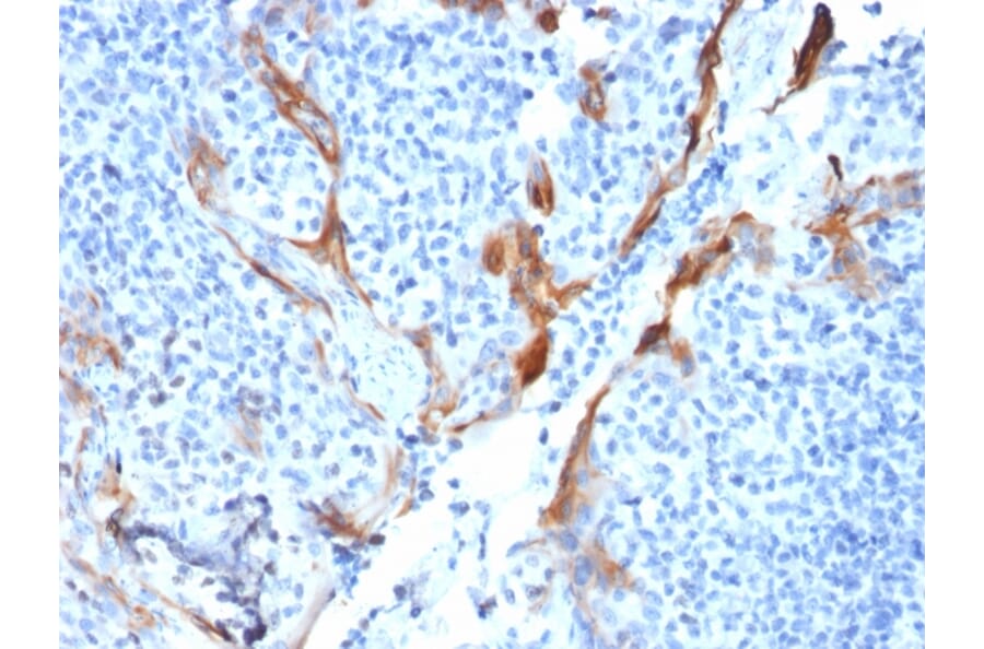 Immunohistochemistry - Anti-Cytokeratin 16 Antibody [KRT16/1714] - BSA and Azide free (A252364) - Antibodies.com