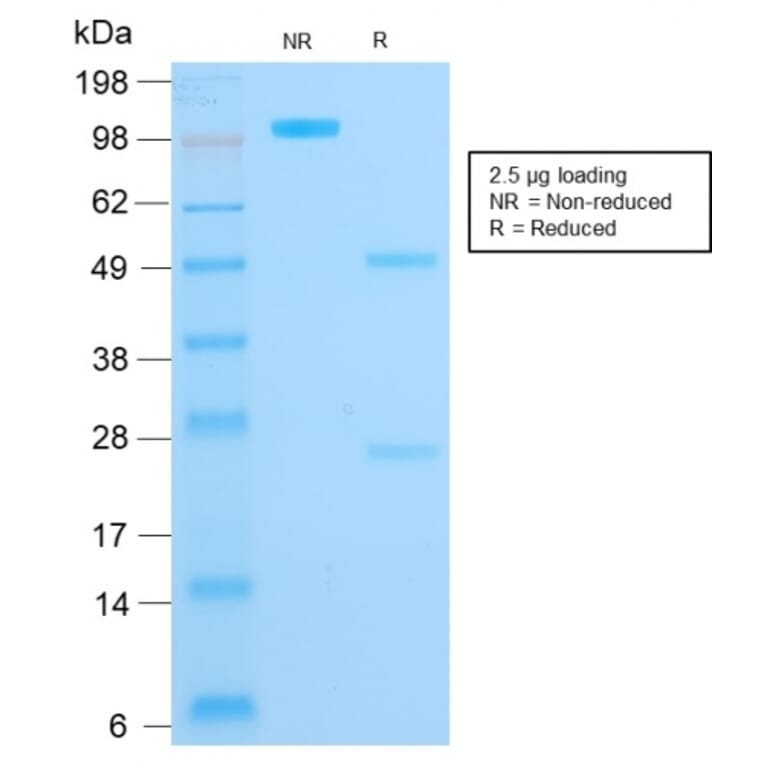 SDS-PAGE - Anti-Cytokeratin 16 Antibody [KRT16/1714] - BSA and Azide free (A252365) - Antibodies.com