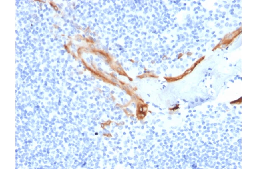 Immunohistochemistry - Anti-Cytokeratin 16 Antibody [SPM264] - BSA and Azide free (A252365) - Antibodies.com