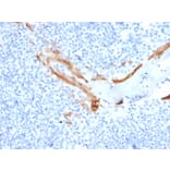 Immunohistochemistry - Anti-Cytokeratin 16 Antibody [SPM264] - BSA and Azide free (A252365) - Antibodies.com