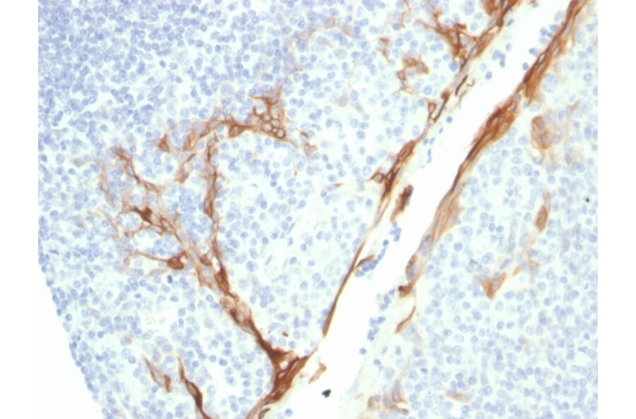Immunohistochemistry - Anti-Cytokeratin 16 Antibody [rKRT16/1714] - BSA and Azide free (A252366) - Antibodies.com