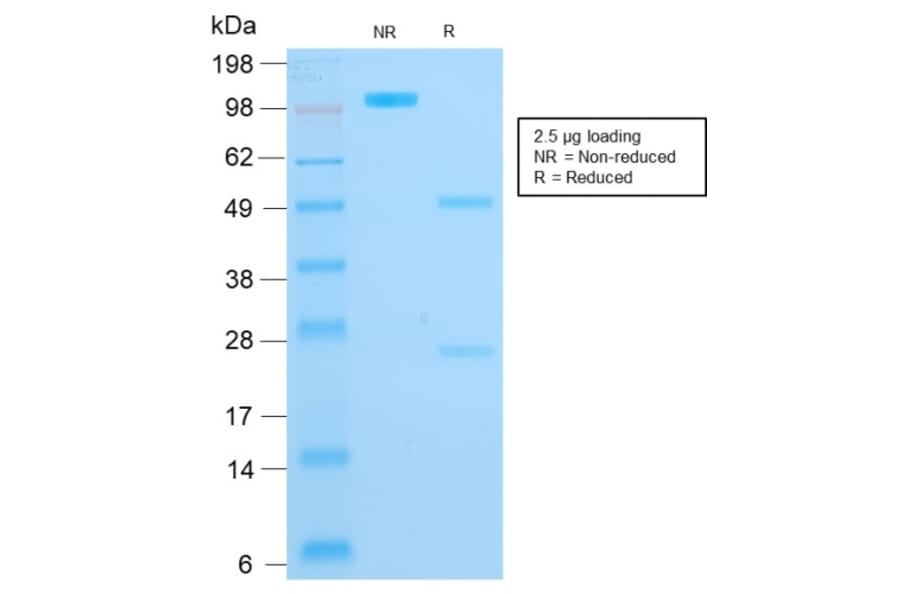 SDS-PAGE - Anti-Cytokeratin 16 Antibody [rKRT16/1714] - BSA and Azide free (A252367) - Antibodies.com