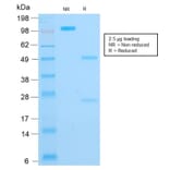 SDS-PAGE - Anti-Cytokeratin 16 Antibody [rKRT16/1714] - BSA and Azide free (A252367) - Antibodies.com