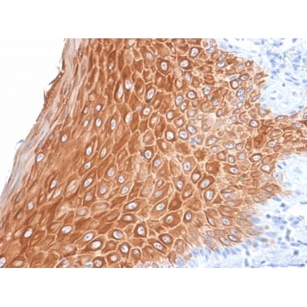 Immunohistochemistry - Anti-Cytokeratin 16 Antibody [KRT16/2043R] - BSA and Azide free (A252367) - Antibodies.com