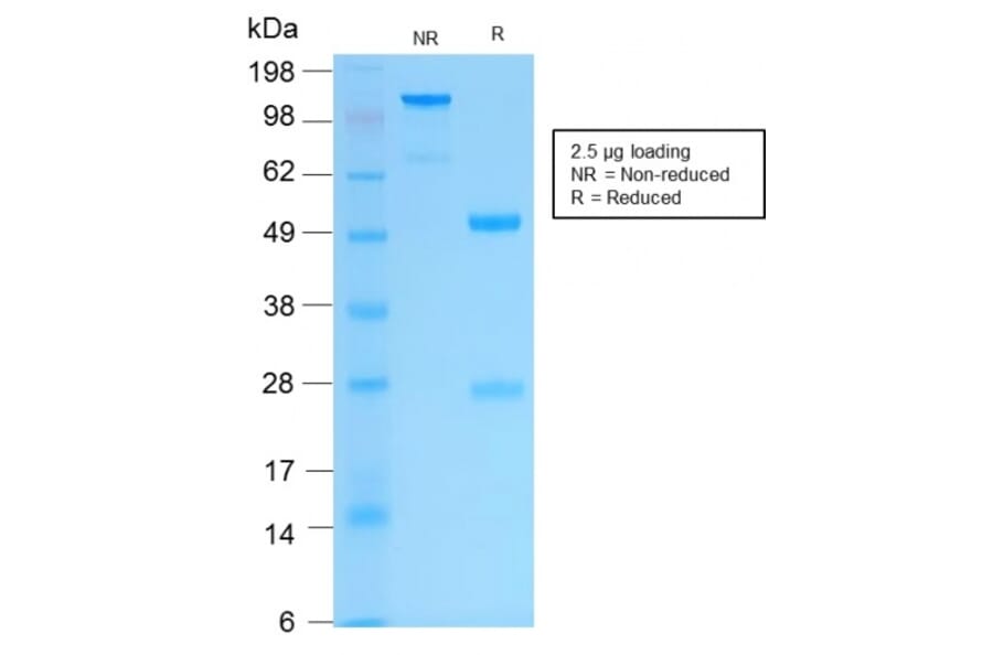 SDS-PAGE - Anti-Cytokeratin 16 Antibody [KRT16/2043R] - BSA and Azide free (A252368) - Antibodies.com