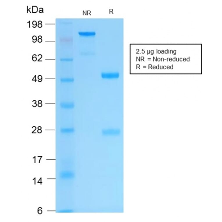 SDS-PAGE - Anti-Cytokeratin 16 Antibody [KRT16/2043R] - BSA and Azide free (A252368) - Antibodies.com