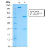 SDS-PAGE - Anti-Cytokeratin 16 Antibody [KRT16/2043R] - BSA and Azide free (A252368) - Antibodies.com