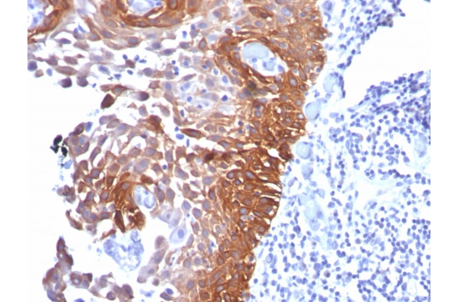 Immunohistochemistry - Anti-Cytokeratin 17 Antibody [E3] - BSA and Azide free (A252369) - Antibodies.com