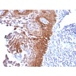 Immunohistochemistry - Anti-Cytokeratin 17 Antibody [E3] - BSA and Azide free (A252369) - Antibodies.com