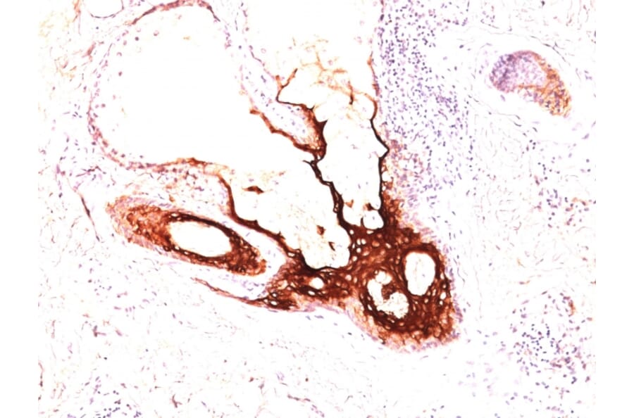 Immunohistochemistry - Anti-Cytokeratin 17 Antibody [SPM560] - BSA and Azide free (A252370) - Antibodies.com